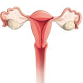 Excisão de pólipo cervical, lesão de vulva e vagina;